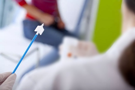 Emakakaelavähi sõeluuringute edusammud: enesekogumise HPV testide roll