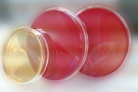 Salmonella Shigella agar (SS): patogeeni isoleerimise oluline sööde
