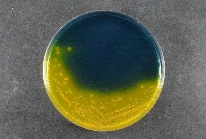 Toiduohutuse tagamine: Babio Salmonella Shigella Agar (SS) toetab ülemaailmseid patogeenide tuvastamise standardeid