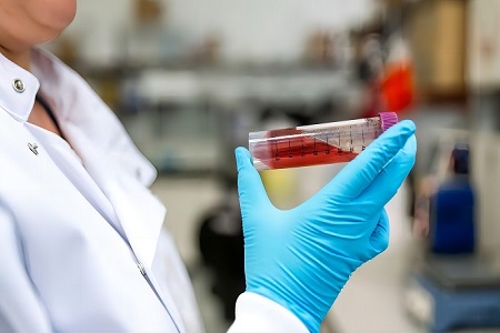 BABIO käivitab usaldusväärse kliinilise proovi transpordi jaoks Liquid Amies Media