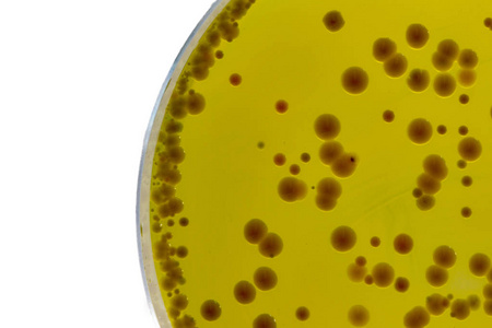 BABIO käivitab kvaliteetse Baird-Parkeri agari aluse usaldusväärseks Staphylococci testimiseks