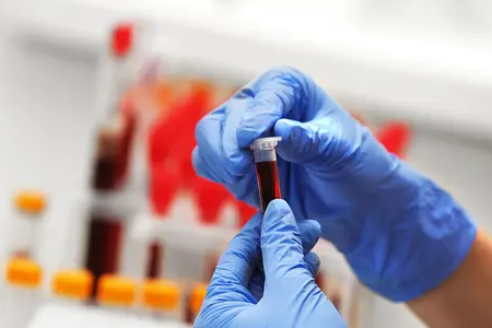 Malaaria kiire tuvastamine: BABIO kahe antigeeni testikomplekt tugevdab ülemaailmset tervist