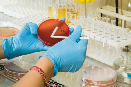 BABIO MacConkey agari sööde – esmaklassiline selektiivne isolatsioon globaalseks mikrobioloogiliseks diagnostikaks